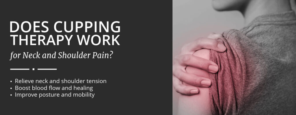 Does Cupping Therapy Work for Neck and Shoulder Pain?